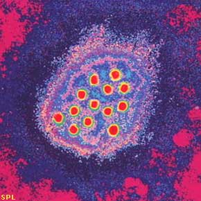 hepatitisa1