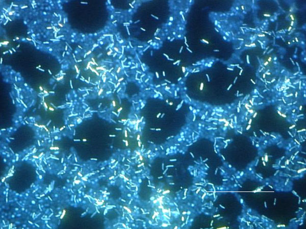Polymicrobic_biofilm_epifluorescence