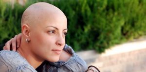bald-woman-e1516127517437-300x149.jpg