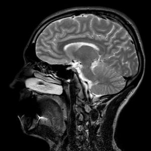 headmri-300x300.jpg