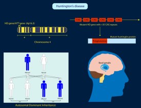 huntington-disease.jpg