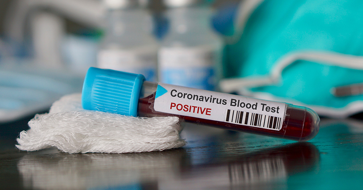 Coronavirus-Blood-Draw_Lab